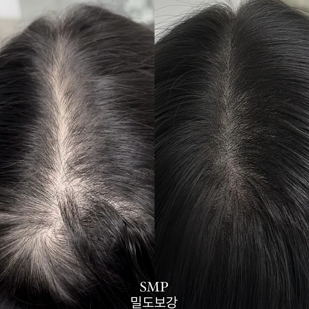 # 정통기법smp / 결(엠보기법) 두피문신 무료 모델모집 #