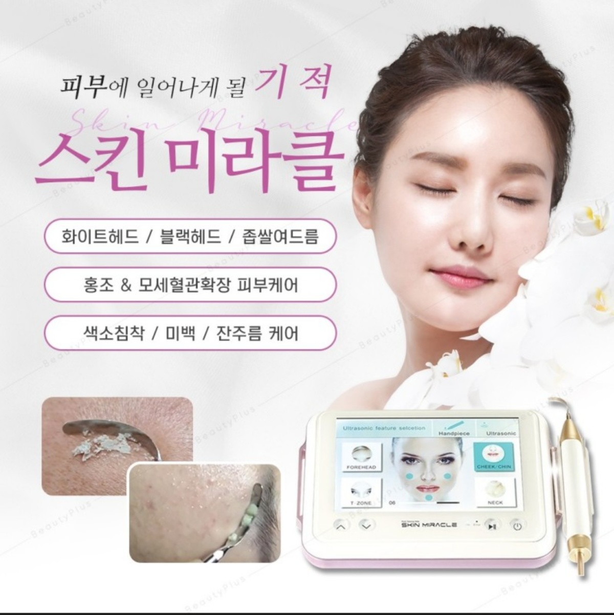 피부무료모델) 포폴모델) 왁싱모델 , 스킨미라클모델(피부) 구합니다!
