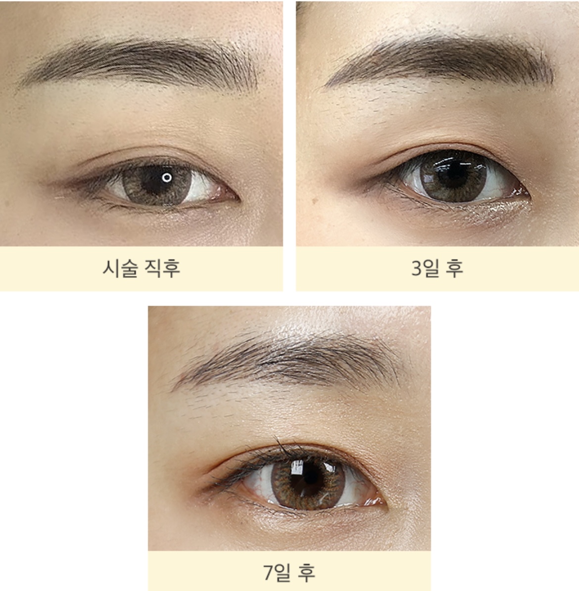 눈썹 반영구
