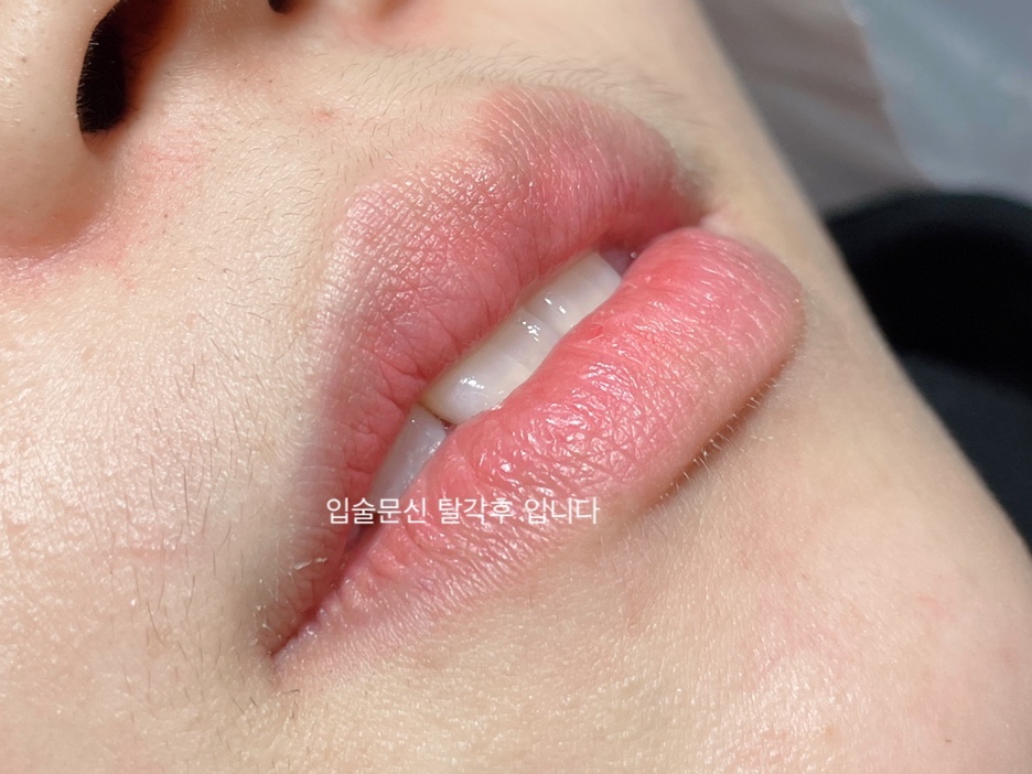 역삼 반영구 모델 구합니다
