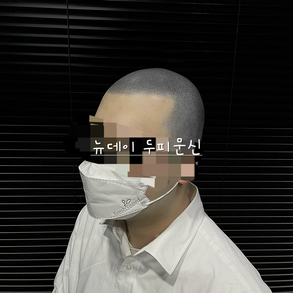 두피문신 삭발과 숱채움 모델구합니다