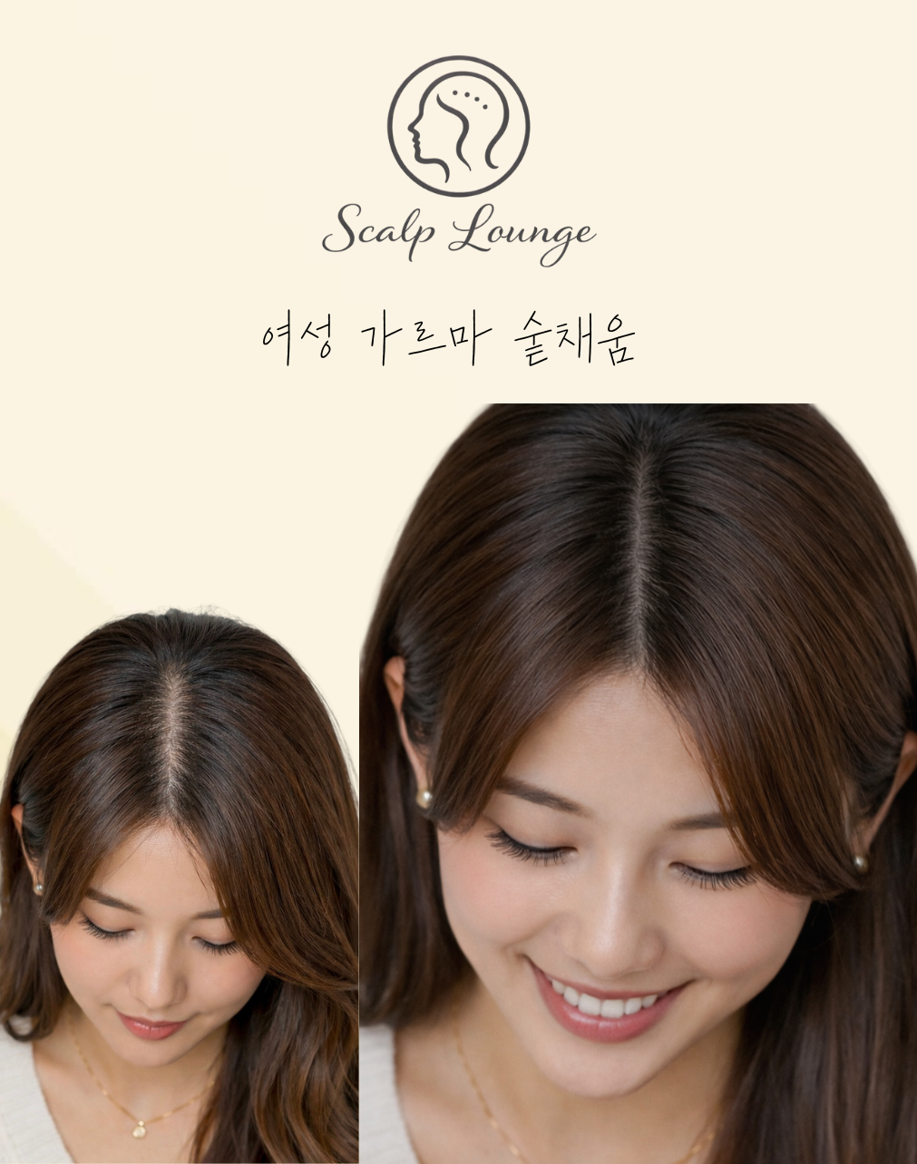 두피 SMP 모델 모집