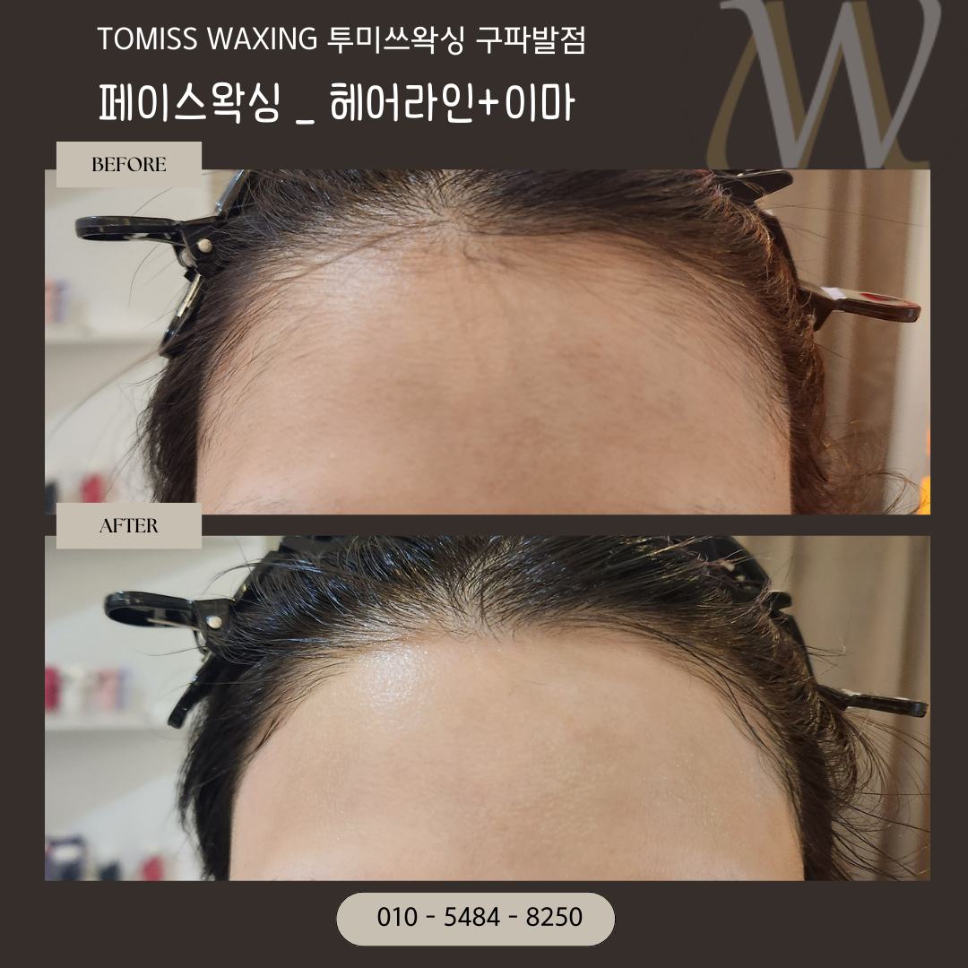 왁싱 블로그체험단 모집합니다!
